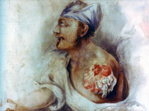 Sergeant Anthony Tuttmeyer 2nd KGL left arm shattered by a shell: Battle of Waterloo on 18th June 1815: picture by Sir Charles Bell the surgeon who treated the soldier